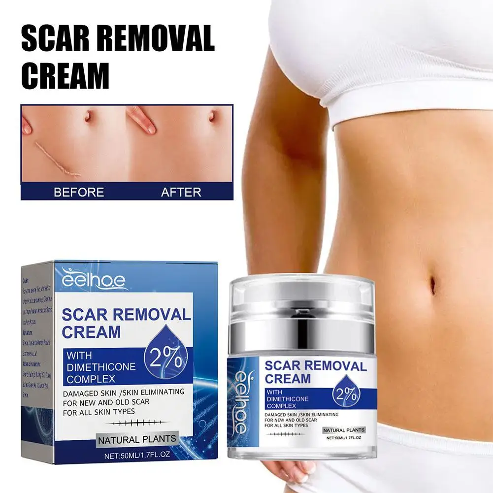 

50ml Scar Repair Cream Stretch Marks Removal Women Skin Care Acne Scars Remove Maternity Fat Striae Gravidarum Body Care