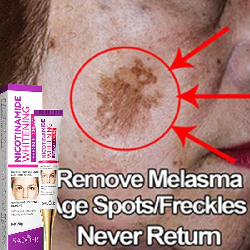 Effective Whitening Freckles Cream Remove Dark Spots Freckle Gel Lightening Melasma Melanin Nicotinamide Brighten Skin Care 20g