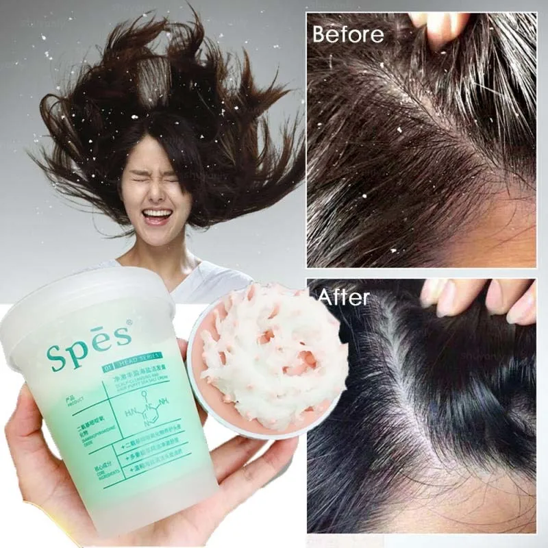 

280ml Spes Sea Salt Hair Shampoo Scalp Scrub Shampoo Oil Control Anti-dandruff Shampoo Fluffy Soothing Hair Vitamins