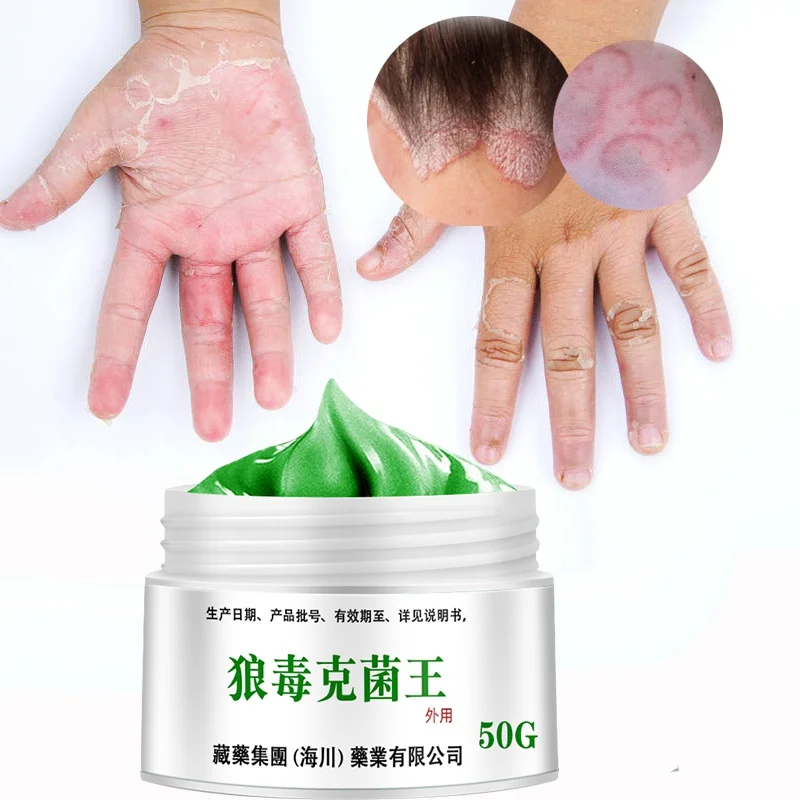 50g Psoriasis Dermatitis Eczematoid Eczema Ointment Anti-Itch Chinese Herb Medical Skin Care Cream | Feet