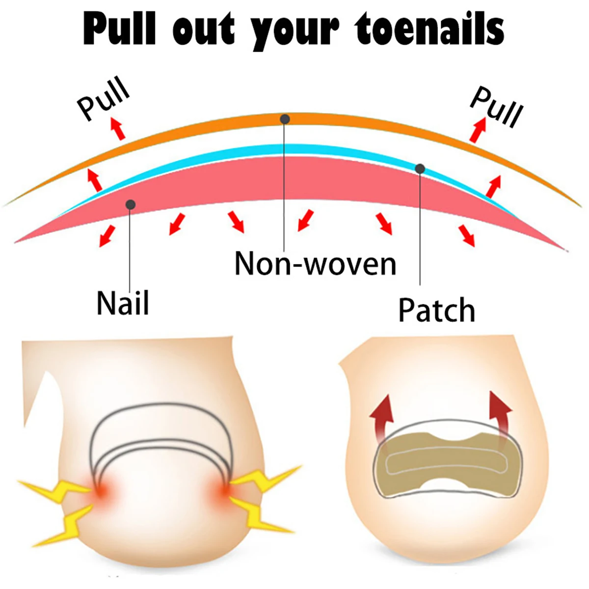

Ingrown Toenail Corrector Patches Nail Correction Stickers Paronychia Treatment Recover Corrector Pedicure Foot Care 100pcs/pack