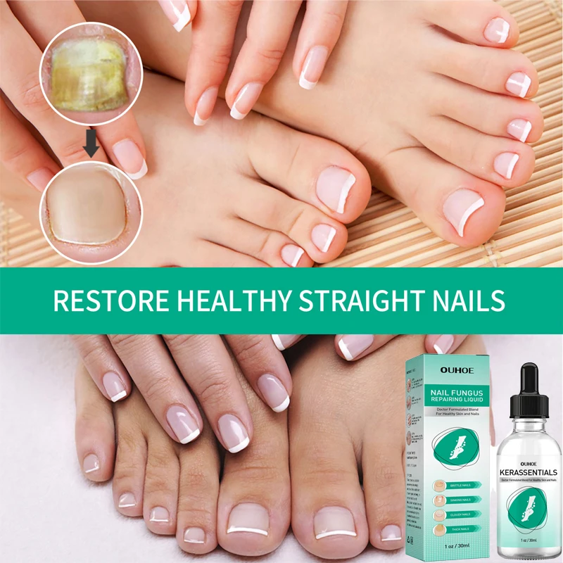 

Nail repair nutrient solution hand and foot thickening onychomycosis soft armor care solution cleaning nail care solution