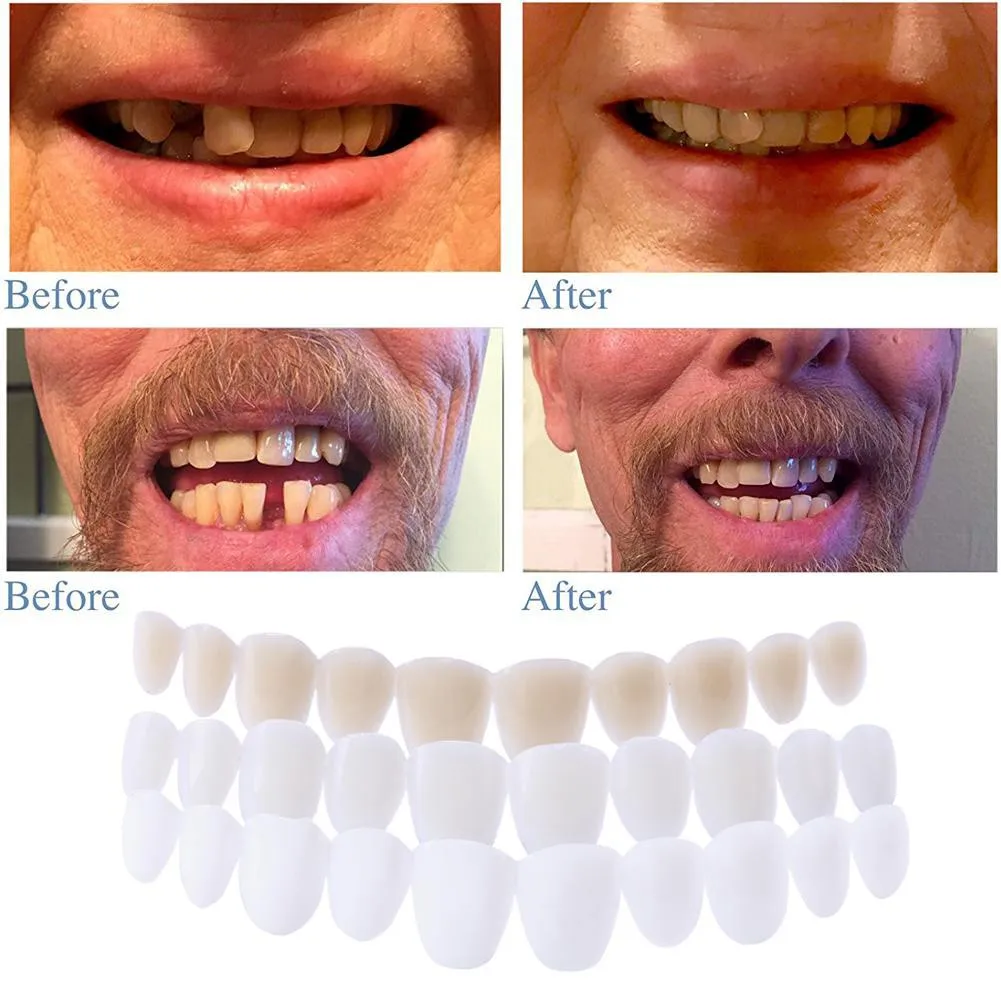 

2022 Perfect Smile Teeth Silicone Simulated Tooth Cover Teeth Whitening Denture Paste Temporary Teeth