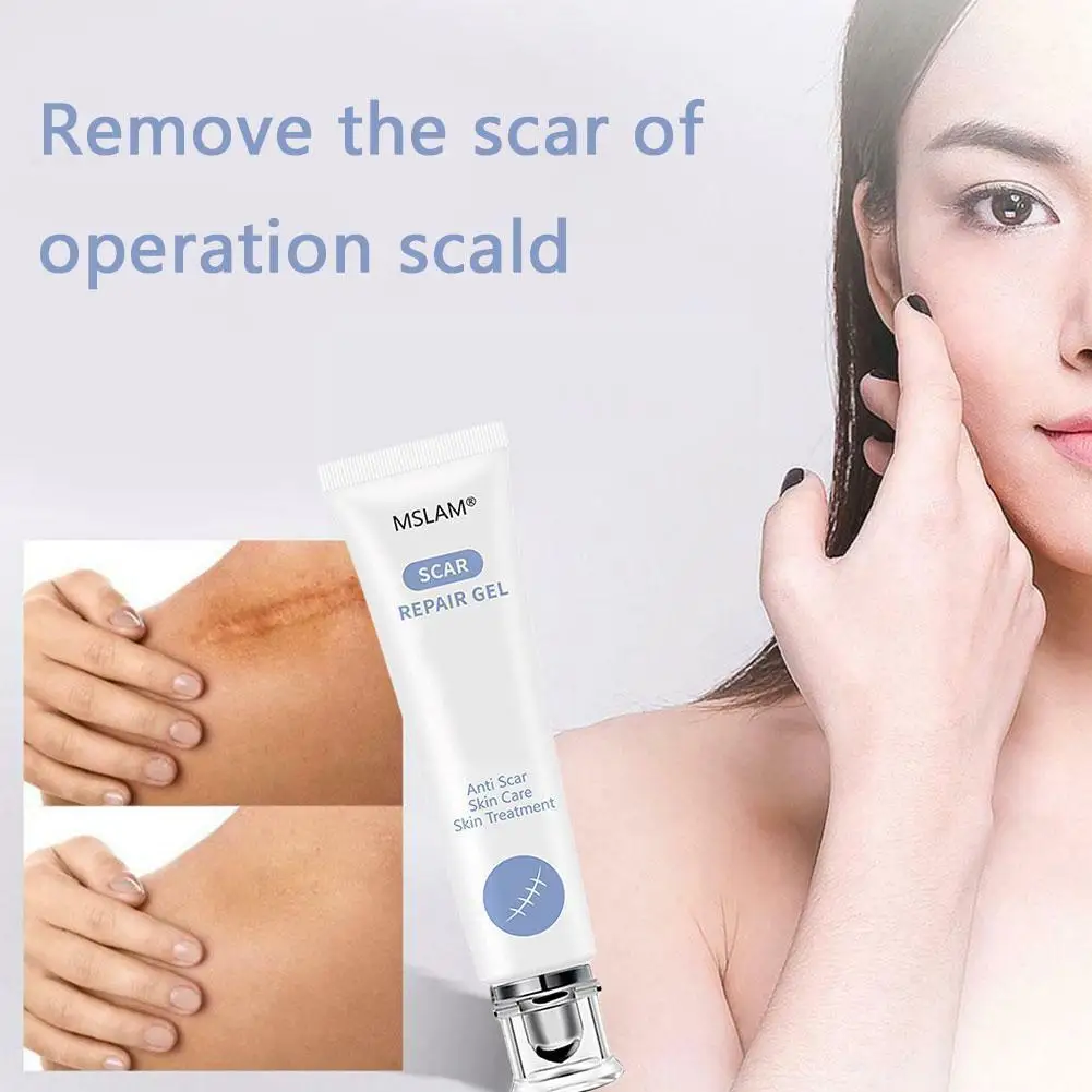 

1pcs Scar cream for vip link Z1A0