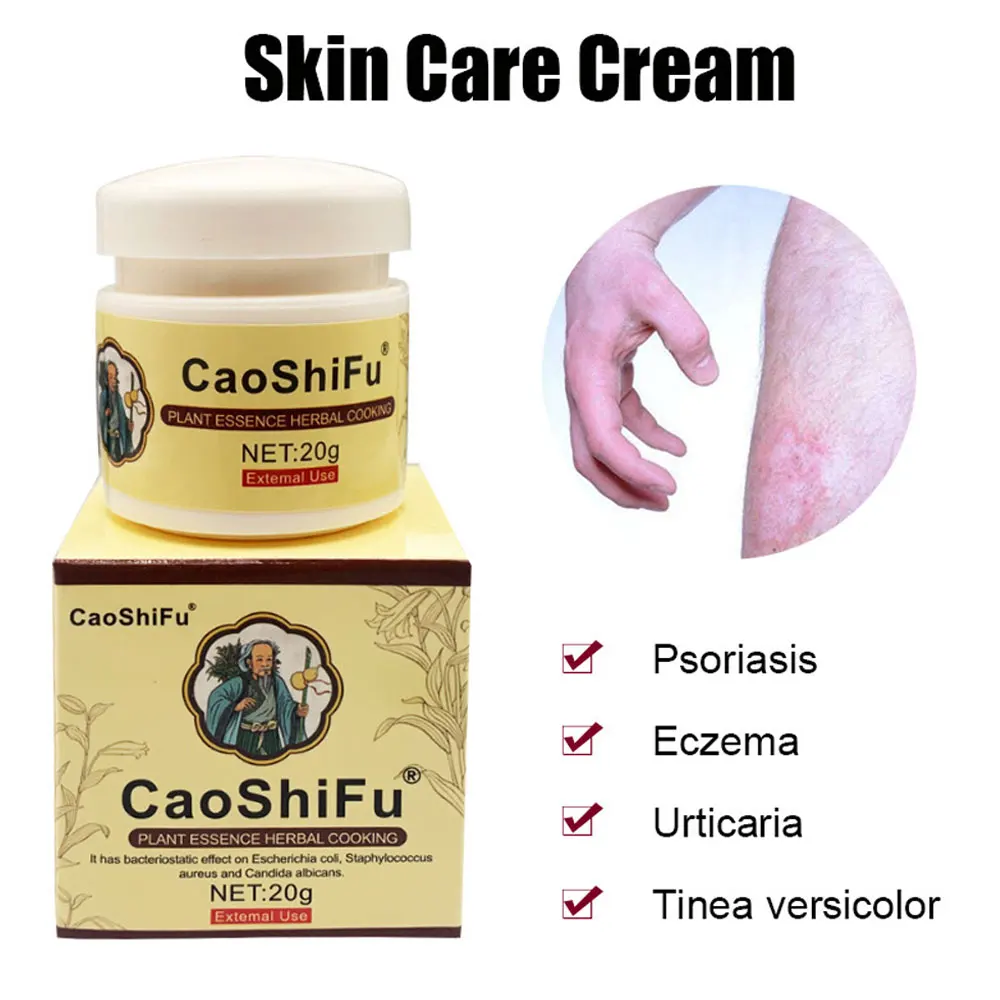 20 г мазь CAOSHIFU от псориаза для проблем на коже крем противозудный медицинский