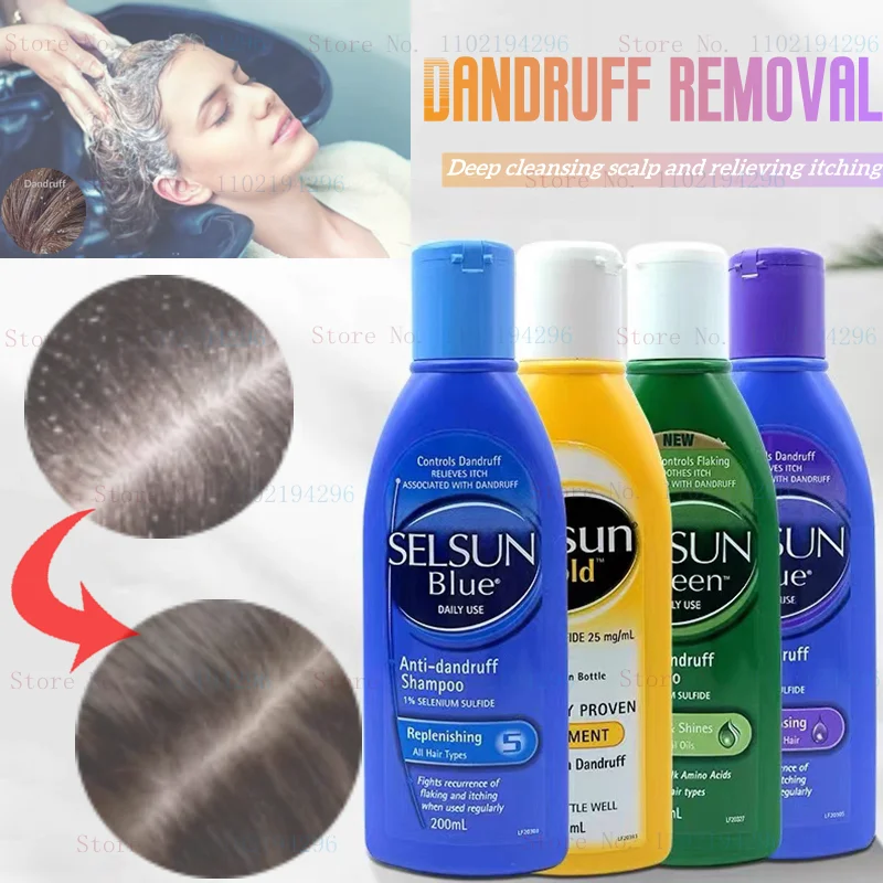 

Australia Selsun Shampoo Dandruff Antipruritic Oil Control Fluffy Shampoo for Men and Women 200ml Silicone Oil-free Shampoo