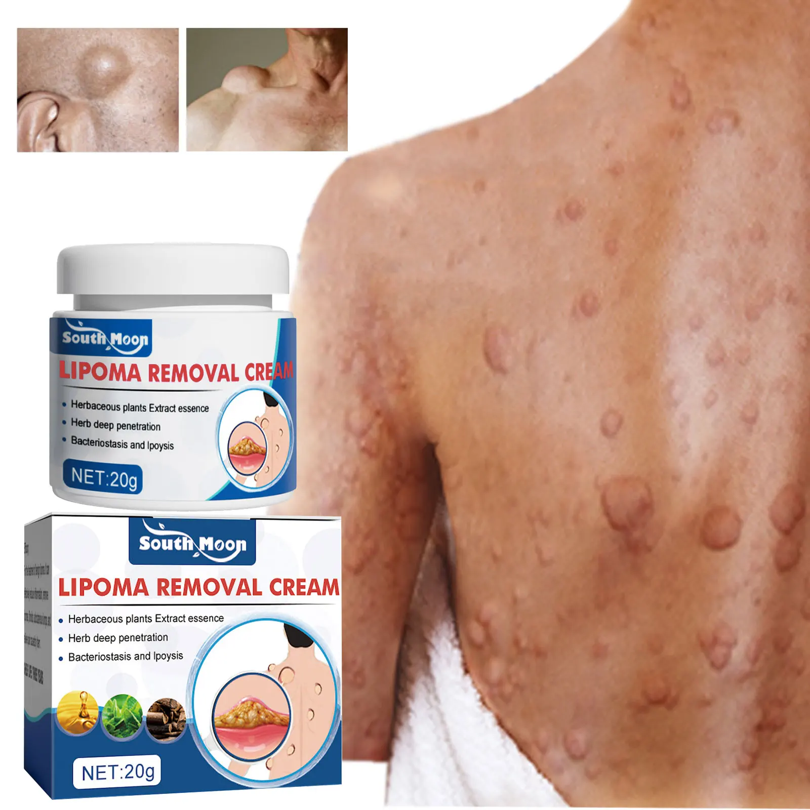 

Anti-Tumor Cream Skin Swelling Cellulite Pain Relief Lymph Node Subcutaneous Lumps Eliminate Multiple Lipoma Removal Ointment