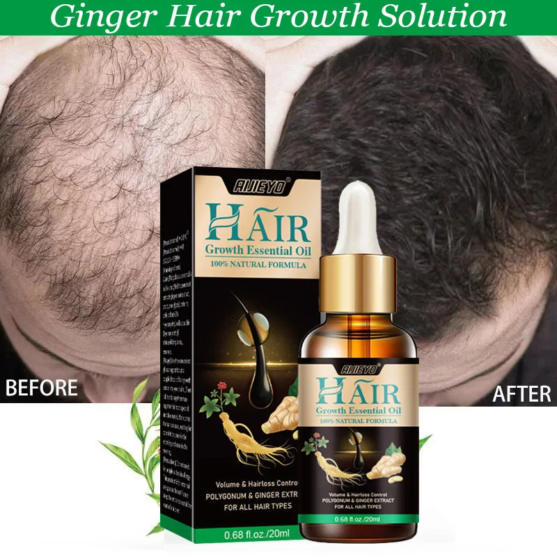 

Fast Hair Growth For Men Ginger Grow Hair Oil Prevent Anti Hair Loss Scalp Treatment Serum Product Care Beauty Health Women 20ml