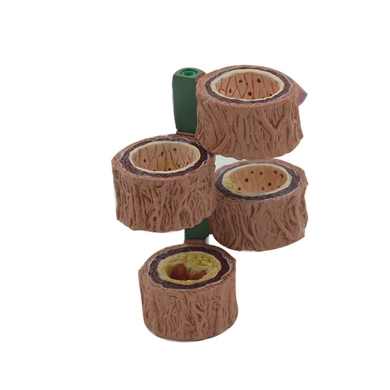 Человеческое тело модель артерии из 4 частей анатомическая Реплика для СКЛЕРОЗА