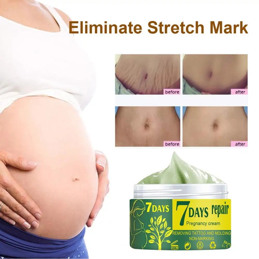 

Natural Extracts Easy to Absorb for Mother Scar Remove Cream Stretch Removal Pregnancy Repair Cream Hot Sale Skin