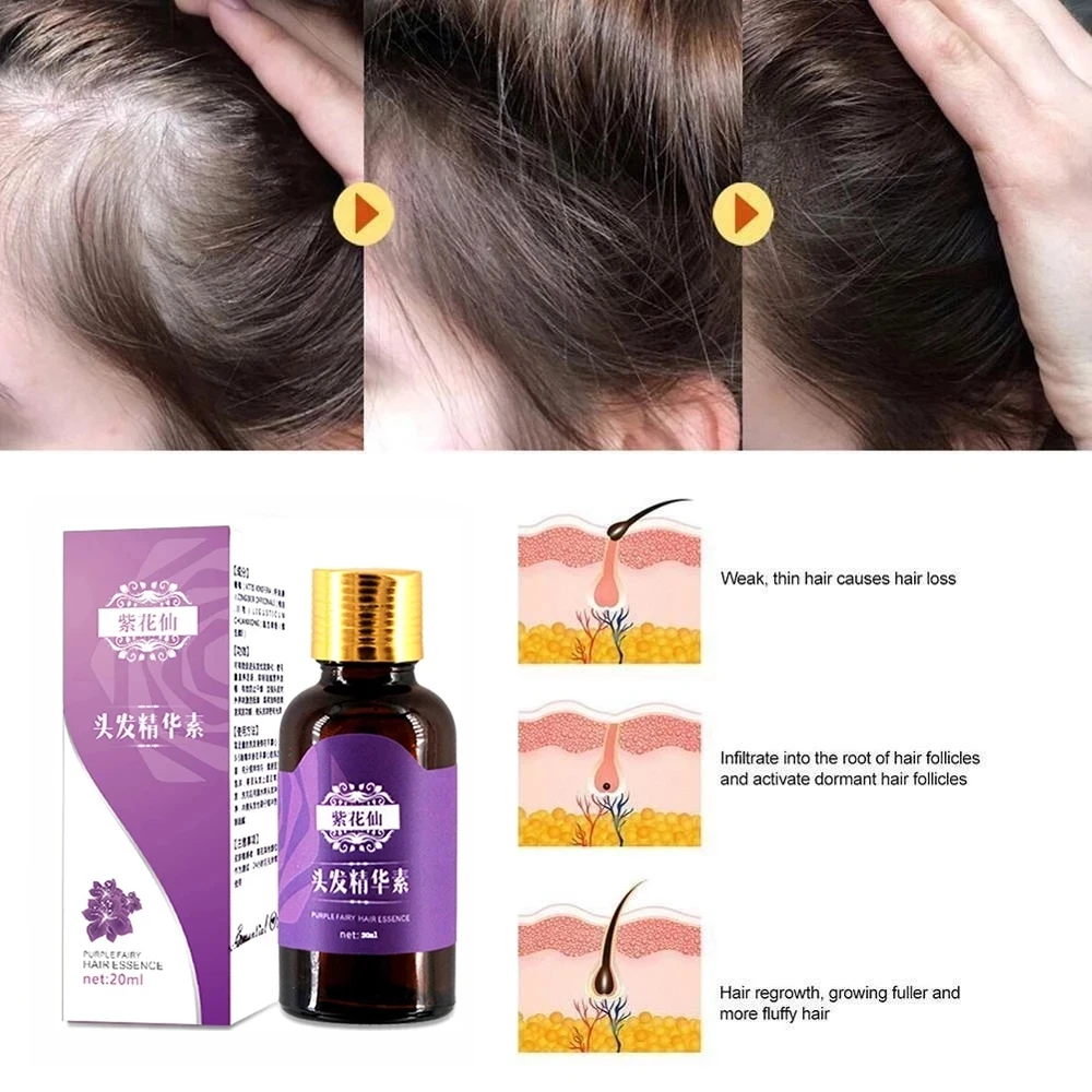 Продукты для роста волос имбирное быстрорастущее эфирное масло красота уход за