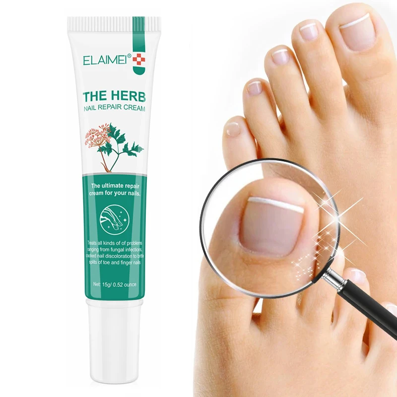 

Herb Fungal Nail Treatment Cream Toenail Fungus Removal Serum Anti Infection Repair Hand Feet Care Gel Paronychia Onychomycosis
