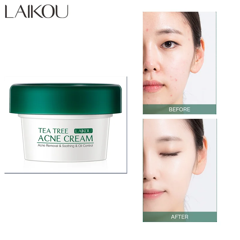 

LAIKOU Tea Tree Anti-Acne Cream Acne Treatments Oil Control Shrink Pores Whitening Moisturizing Anti-Aging Face Skin Care Unisex