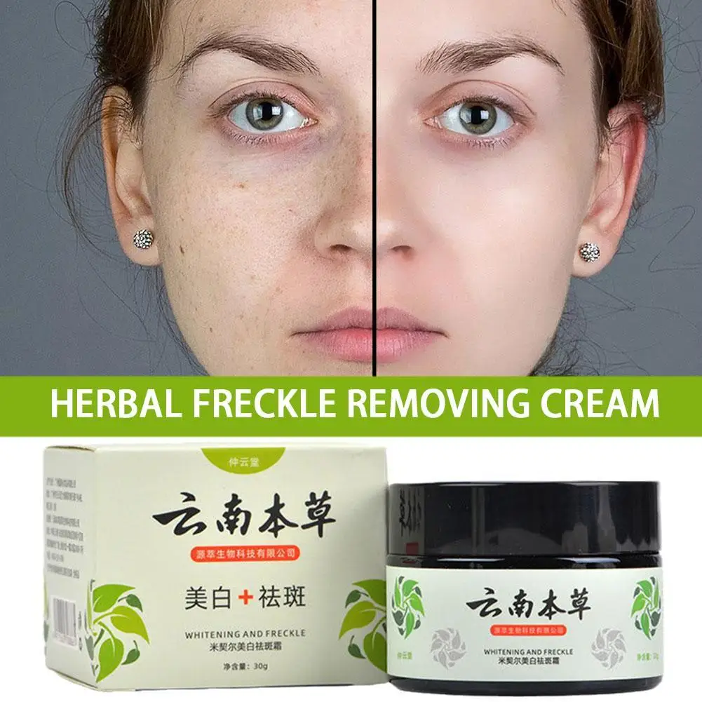 

Yunnan Herbal Whitening and Freckle Removing Cream Lighten Stain Lightening Sunburn Freckle Chloasma Moisturizing face cream