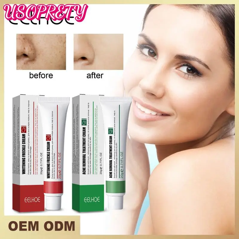 

Whitening Cream Face Freckle Remove Dark Spots Fade Acne Scar Removal Pigmentation Melasma Anti-Aging Brighten Skin Repair Cream