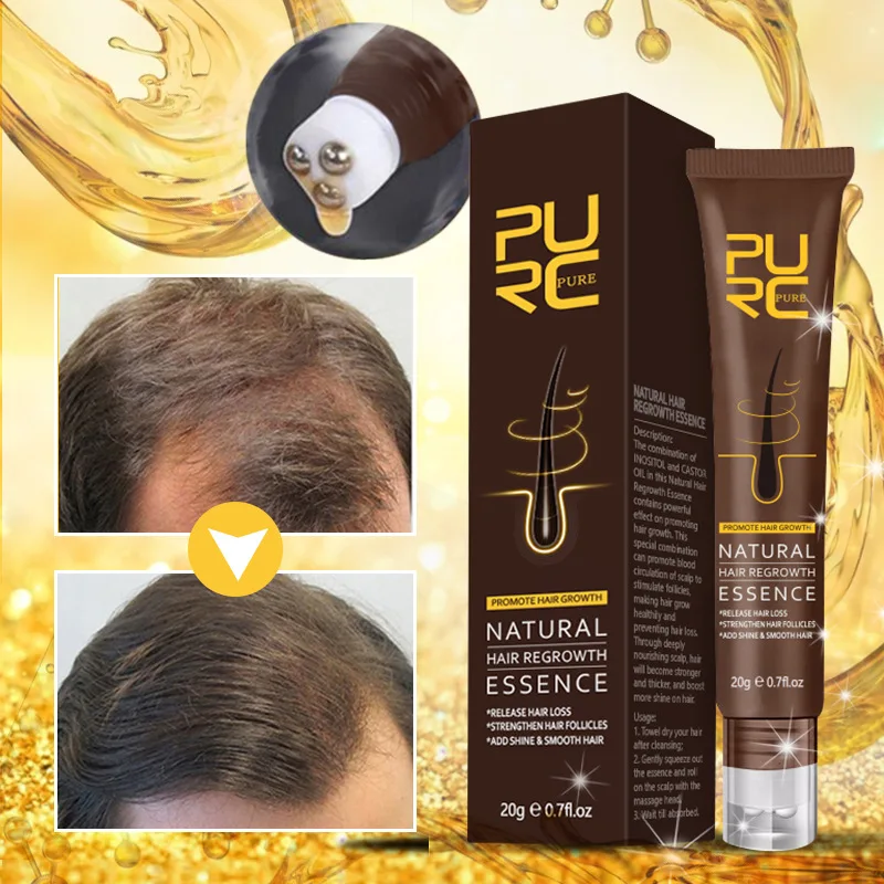 

20g ginger hair gel growth liquid becomes thicker oil-controlling nourishing anti-hair loss scalp Polygonum multiflorum essence