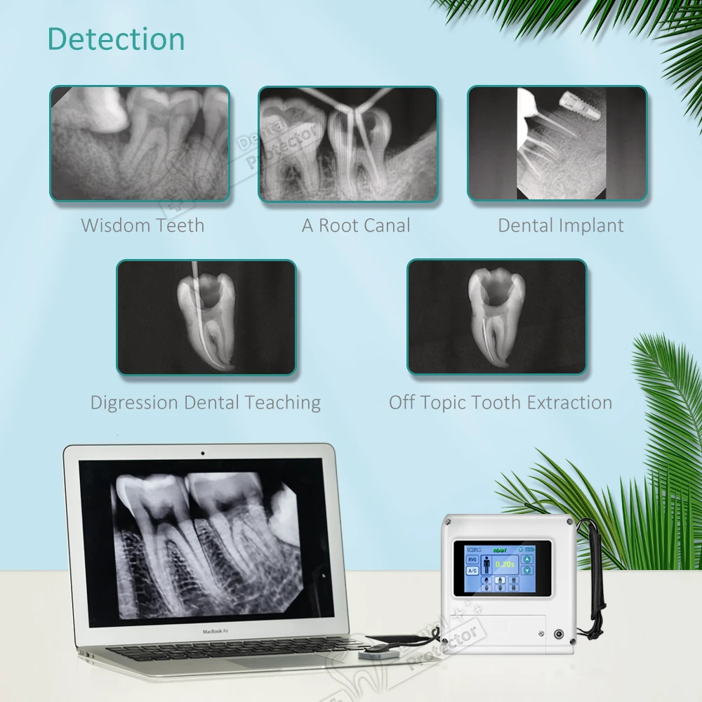 Рисунок 4 - Оригинальная рентгеновская камера