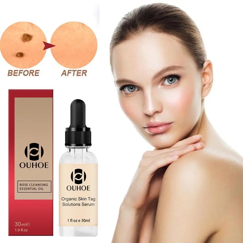 

30ml Organic Tags Solutions Serum Skin Tag Remover Serum Organic Skin Tag Remover Serum Face Wart Tag Mole Freckle Painless