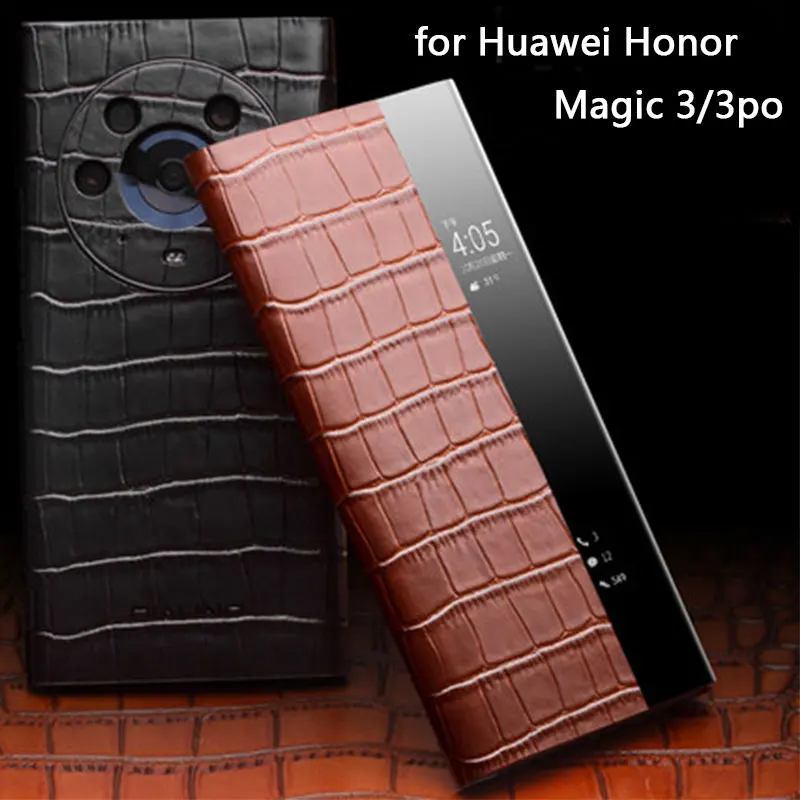 

Luxury Cow Genuine Leather Case For Honor Magic 4 3 Pro Smart Phone Cover For Magic4 Magic3 Pro Flip Window View Funda Skin Bag