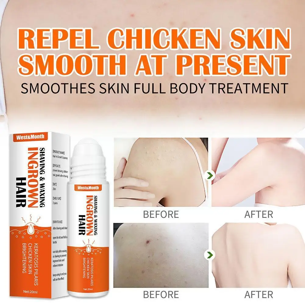20ml Ingrown Hair Cream Bump Removal Stopper Treatment Serum Redness Prevent Waxing Repairing After Shaving Reduce Skin E8Q9 - купить по