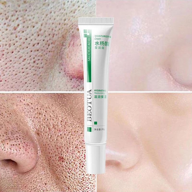 

Salicylic Acid Shrink Pores Face Cream Acne Treatment Remove Blackheads Oil Control Moisturizing Firm Whitening Korean Cosmetics