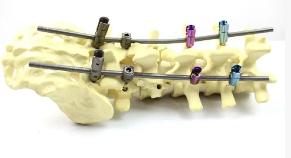 Каркас для поясничного сустава обучающая модель