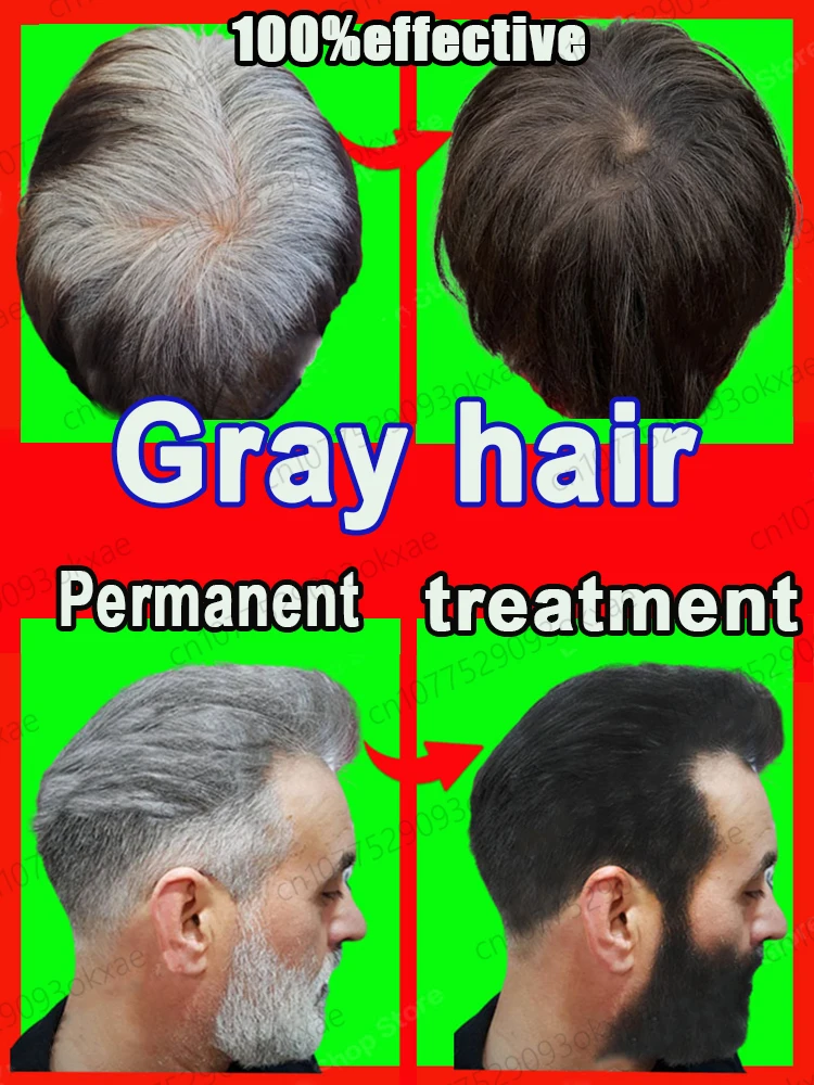Anti Gray Hair Serum White Darkening Natural Hair Color