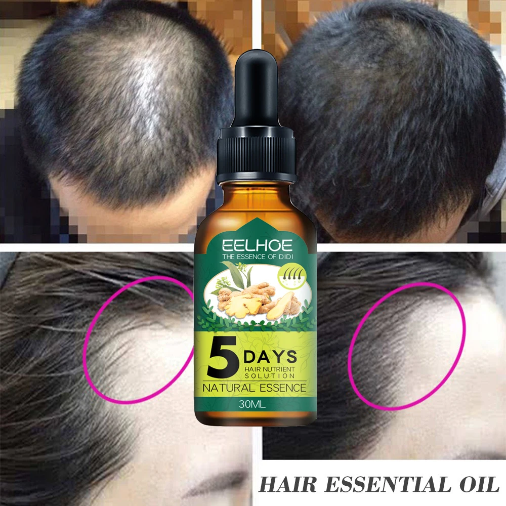5 Days Ginger Hair Care Essential Oil Fast Hair Growth Serum Prevent Hair Loss Repair Thinning Dry Damaged Scalp Beauty Health