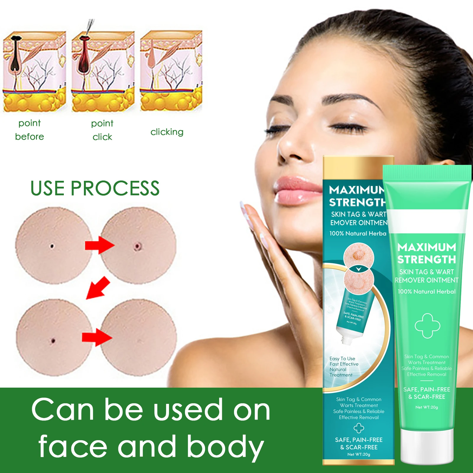 

1 шт., безболезненное средство для удаления родинок, пятен, бородавок