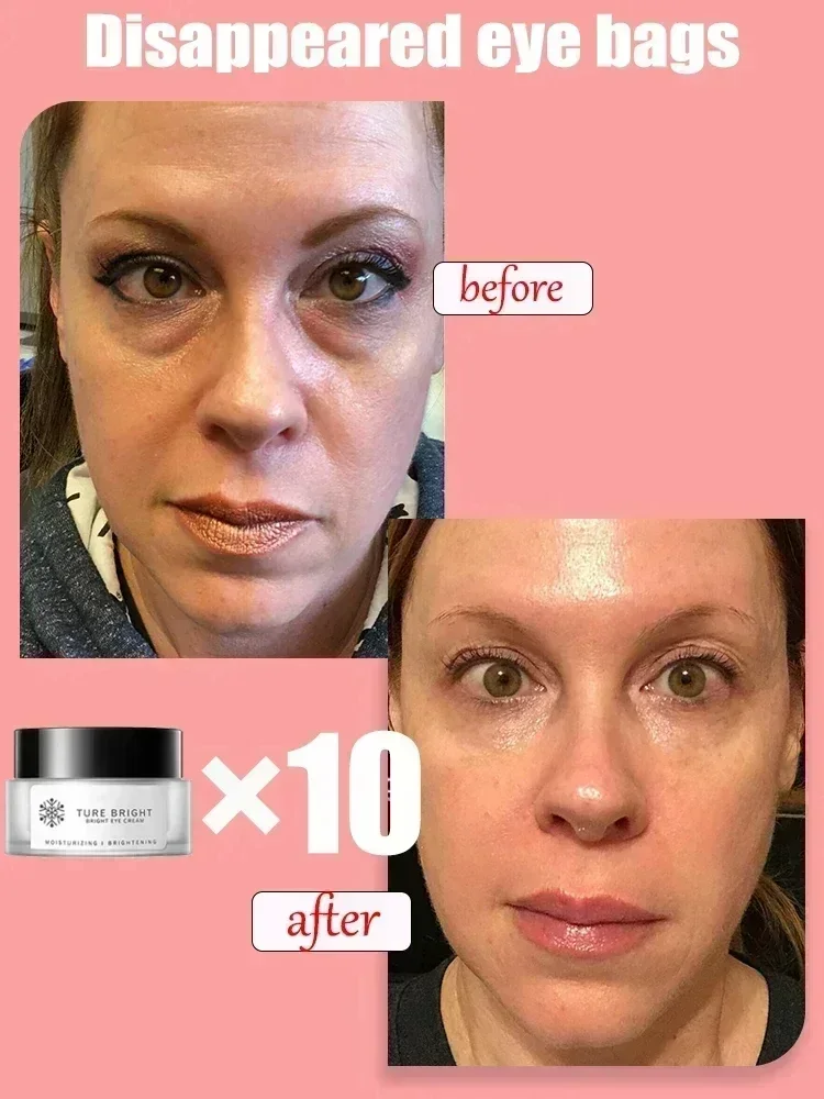 Крем для глаз против темных кругов VC отбеливающая осветляющая фотоблестящая