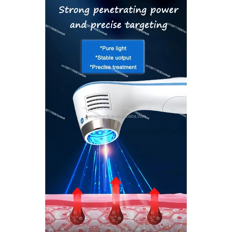 Эффективное портативное извлекательное лазерное устройство для домашнего