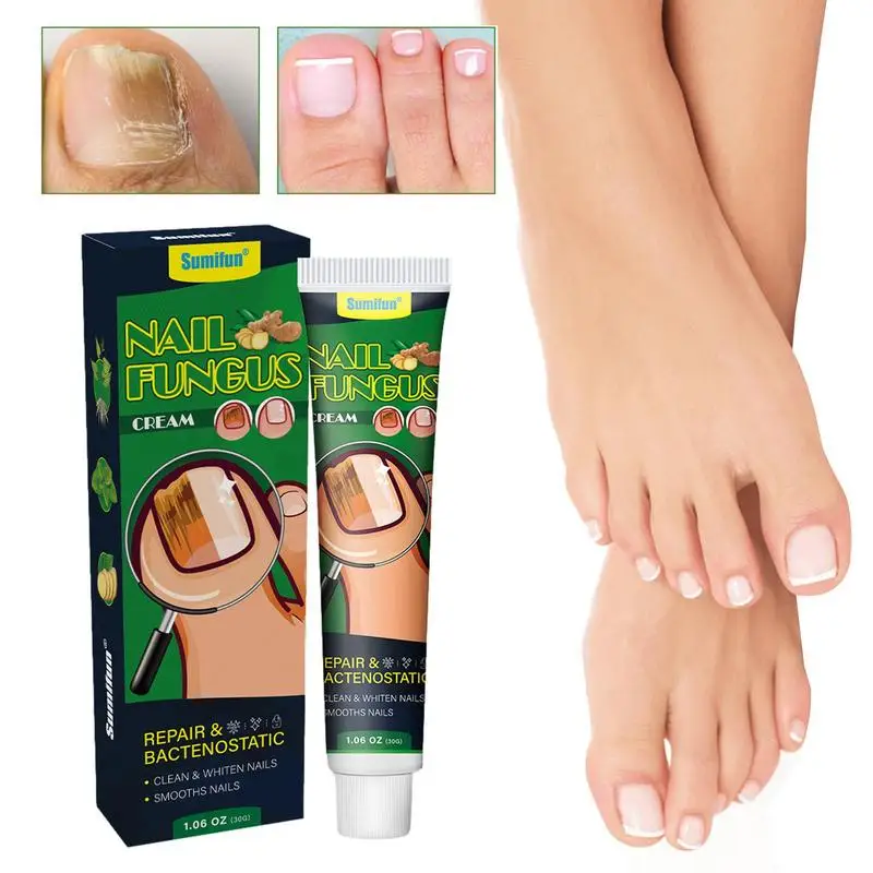 

Средство для укрепления ногтей, 1,06 унции