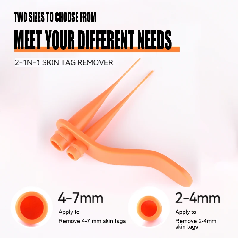 

Набор для удаления родинок и бородавок для взрослых, средство для удаления бородавок, очистительные тампоны