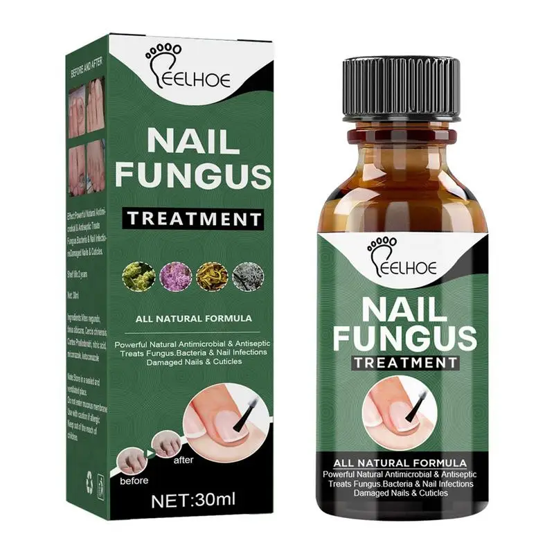 

Спрей для удаления онихомикоза и поврежденных ногтей