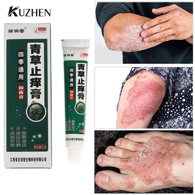 

20 г травяной Антибактериальный крем против зуда экзема