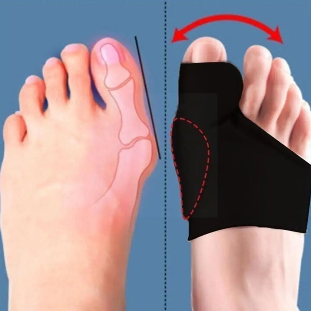 

1pair Sebs Hallux Valgus Braces Toe Orthopedic Correction Separator Sleeve Toes Protect Care Pain Bone Feet Thumb Relieve S H7g8