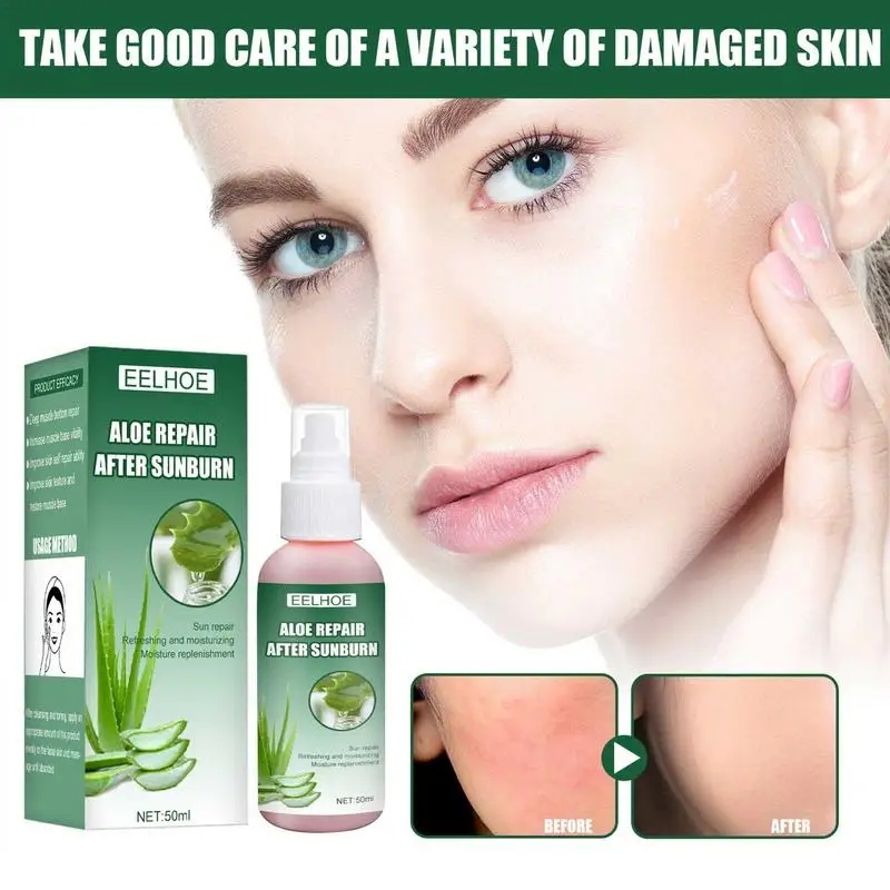 

Organic AloeVera Sunburn Relief 50ml Multifunctional Moisturizer Spray Easy To Carry Soothing Spray After Sun Care Best Gift