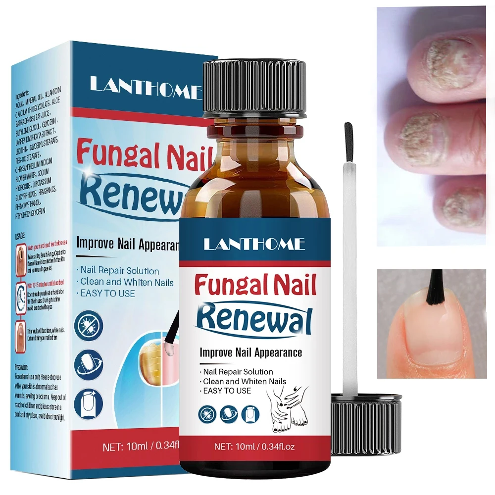 Antifungal Nail Polish Nail Solution Cleansing Whitening Nails Nourishing Rejuvenating Nail Discoloration Regenerating Toenails