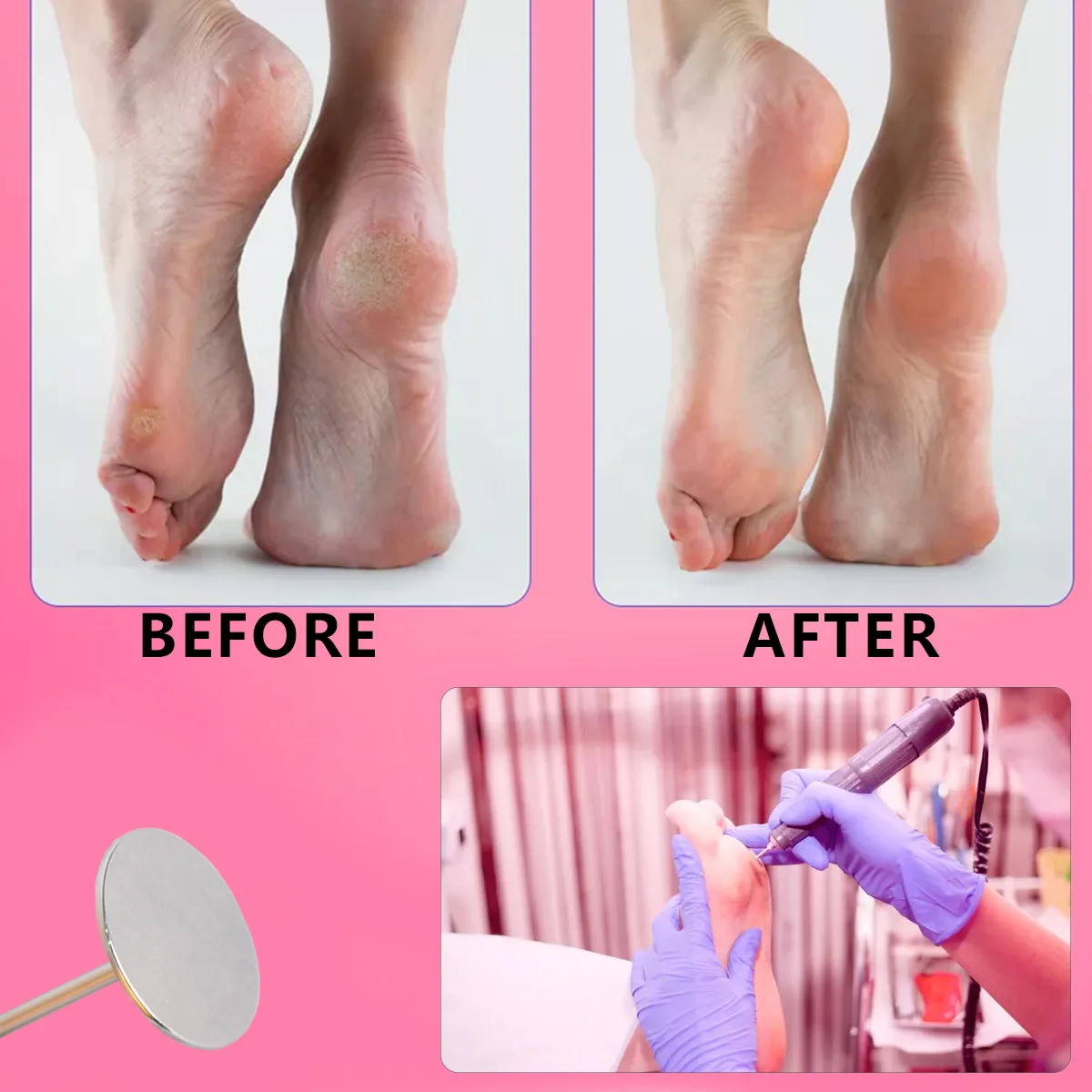 Сменная шлифовальная бумага для удаления кутикулы и мозолей на ногах 20 мм