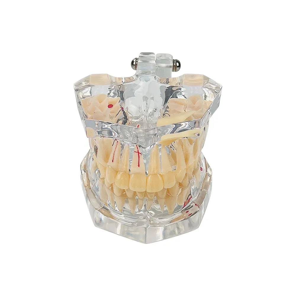 Модель зубов для стоматологической патологии 2 5 раза стоматология обучающая