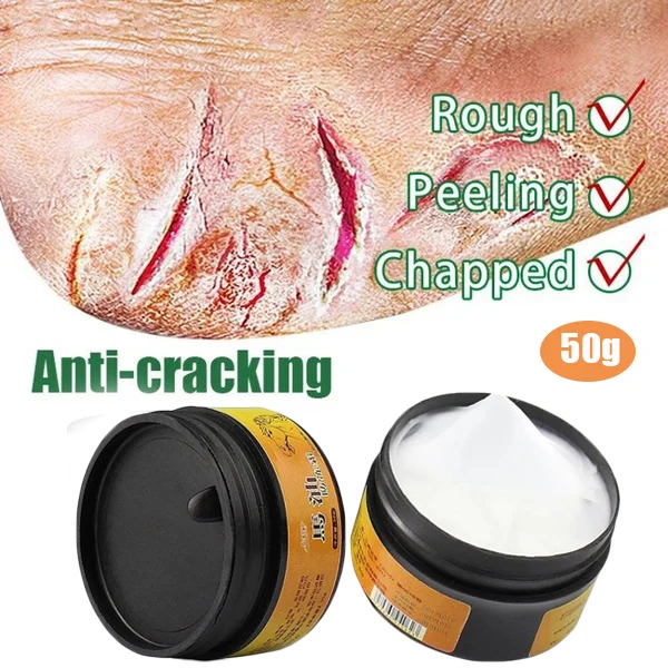 

10/30/50g Horse Oil Hand Foot Crack Cream Heel Chapped Peeling Foot Hand Repair AntiDry Crack Skin Ointment Cream Hand Feet Care