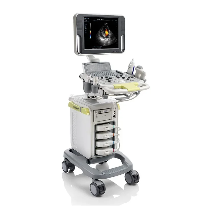 Система ультразвуковой визуализации