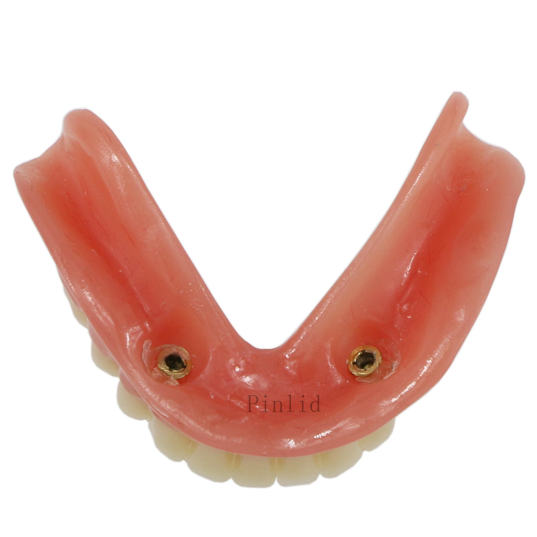 Модель зубного имплантата Overdenture Inferior 2 имплантаты для нижних зубов
