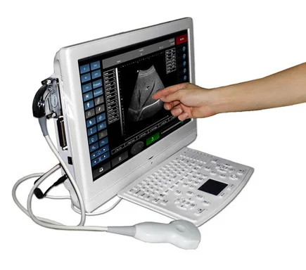 Powerful Function Touch Screen LCD Black And White Ultrasonic Small Size Portable Ultrasound Scanner With Convex Probe