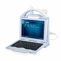 high effective china medical single energy portable dexa scan density meter ultrasound bone densitometer price
