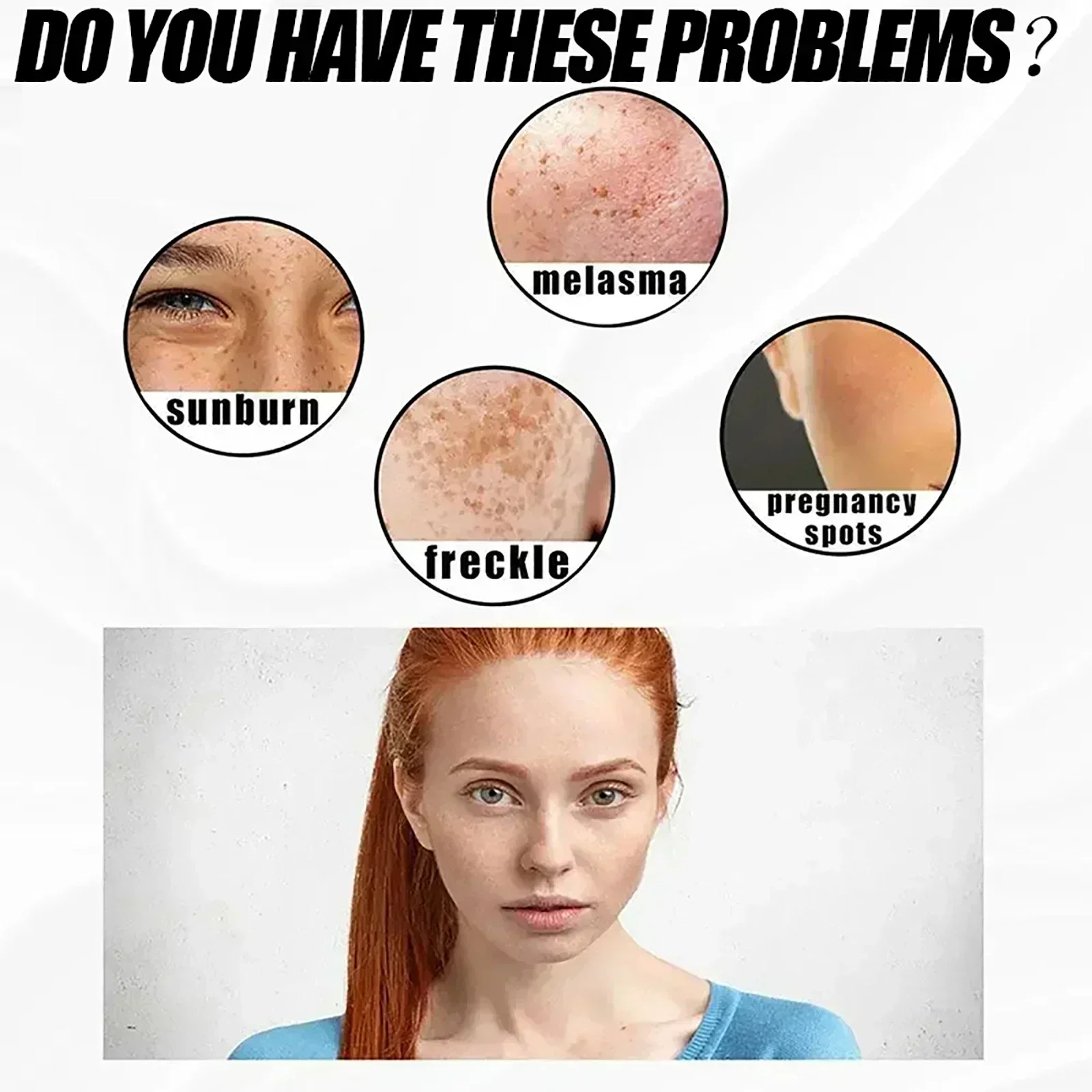 ГОРЯЧАЯ ПРОДАЖА отбеливание веснушек осветление кожи лица укрепляющие продукты