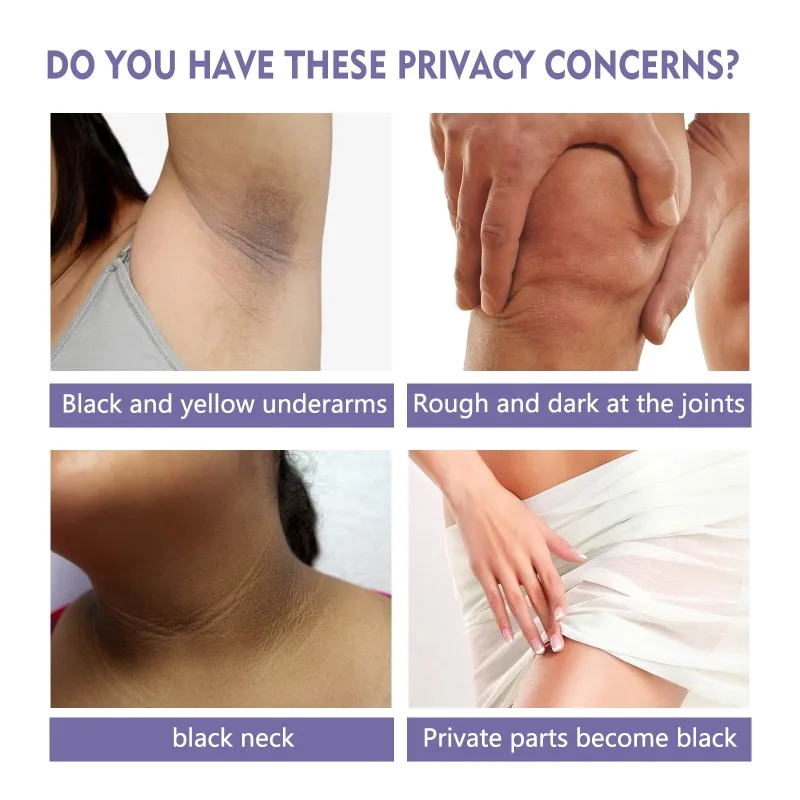 Крем для быстрого отбеливания темной кожи