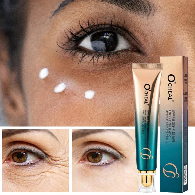 

Improve Dark Circles Eye Cream Fade Fine Lines Remove Eye Bags Anti Wrinkle Anti Aging Nourishing Firming Brighten Skin 30g