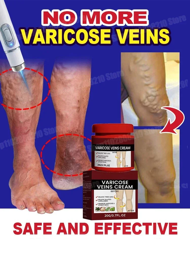 Антибактериальный крем от псориаза опояскивающий пенис экзема герпес