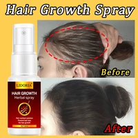 20ml anti hair loss fast hair growth serum spray essential oil liquid scalp for men women loss natural beauty health hair care